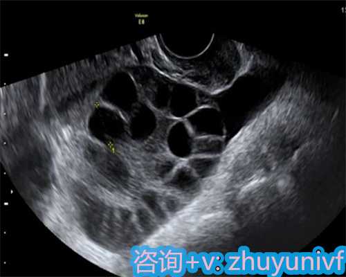 上海代孕机构地址为不孕不育夫妻托起一片明媚天空