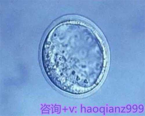 54岁没有月经福建借卵子生子,泰国试管技术为什么比国内好？为什么泰国试管婴