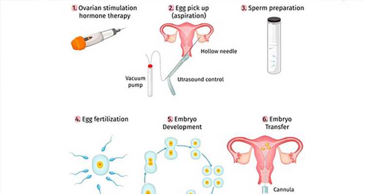 高龄借卵价格，试管婴儿着床后的注意事项